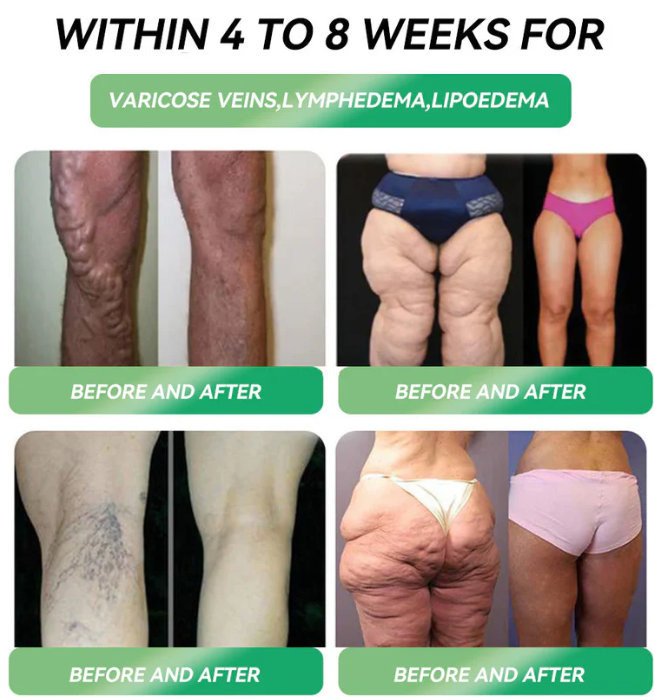đŹđ§ PEAKAÂŽ 6-in-1 Health Drops đ¨ Just one small dose dailyâsee results in as little as a week. Helps maintain a healthy weight, heart function, stabilize blood sugar, improve sleep, relieve joint discomfort, and more.