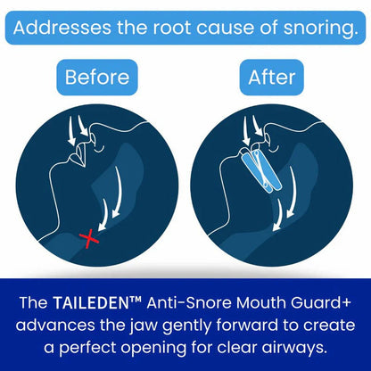 Anti-Snore Mouth Guard+